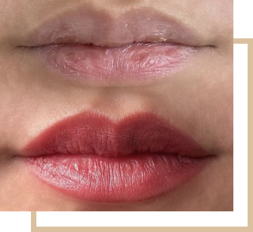 Lip Blush before after
